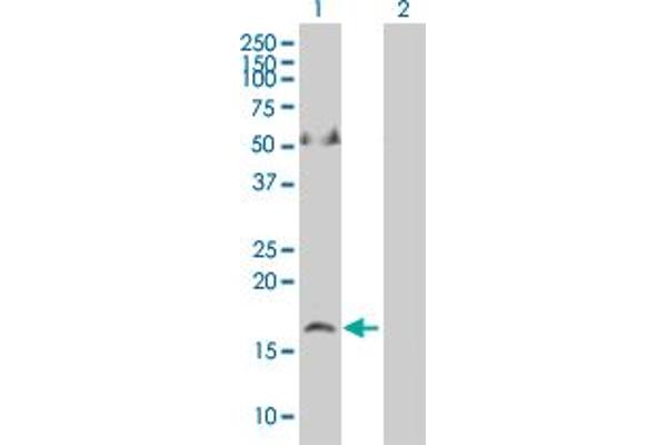 Apelin Antikörper  (AA 1-122)