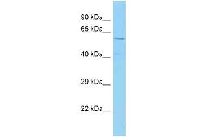 WB Suggested Anti-ZNF835 Antibody Titration: 1.