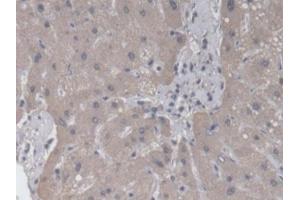 Immunohistochemistry (IHC) image for anti-RAB37, Member RAS Oncogene Family (RAB37) (AA 19-220) antibody (ABIN7430162)