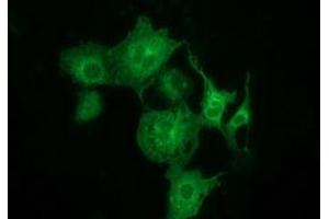 Immunofluorescence (IF) image for anti-Myotubularin Related Protein 14 (MTMR14) antibody (ABIN1499588)