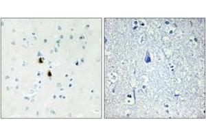 Immunohistochemistry analysis of paraffin-embedded human brain tissue, using IPKA Antibody. (PKIA Antikörper  (AA 10-59))