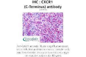 Image no. 1 for anti-Chemokine (C-X-C Motif) Receptor 1 (CXCR1) (C-Term) antibody (ABIN1733391) (CXCR1 Antikörper  (C-Term))