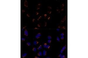 Immunofluorescence analysis of U-2 OS cells using MTCH2 Polyclonal Antibody  at dilution of 1:100 (40x lens). (MTCH2 Antikörper  (AA 30-175))