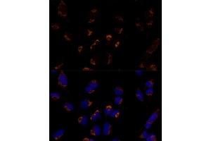 Immunofluorescence analysis of U-2 OS cells using MTCH2 Polyclonal Antibody  at dilution of 1:100 (40x lens). (MTCH2 Antikörper  (AA 30-175))