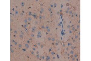 IHC-P analysis of brain tissue, with DAB staining. (DLG5 Antikörper  (AA 1724-1917))