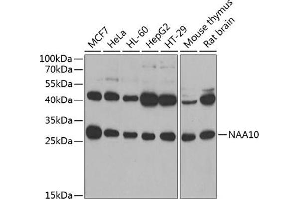 NAA10 anticorps  (AA 161-235)