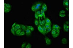 Immunofluorescence staining of HepG2 cells with ABIN7172695 at 1:100, counter-stained with DAPI. (TAF7L Antikörper  (AA 1-98))