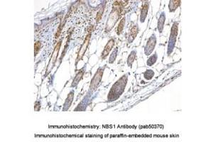 Image no. 1 for anti-NLR Family, Pyrin Domain Containing 2 (NLRP2) (AA 150-200) antibody (ABIN363677) (NLRP2 Antikörper  (AA 150-200))