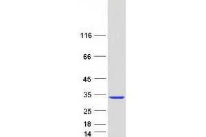 Western Blotting (WB) image for IPP Isomerase 2 (IDI2) protein (Myc-DYKDDDDK Tag) (ABIN2723772)