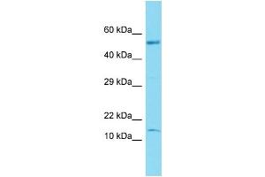 Host: Rabbit Target Name: C17orf103 Sample Type: Fetal Brain lysates Antibody Dilution: 1. (GTLF3B Antikörper  (N-Term))