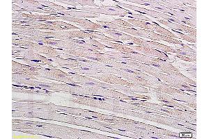 Formalin-fixed and paraffin embedded rat myocardium tissue labeled with Anti-Connexin-40 Polyclonal Antibody, Unconjugated (ABIN736926) at 1:200, followed by conjugation to the secondary antibody and DAB staining (Cx40/GJA5 Antikörper  (AA 301-358))