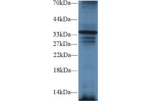 Western blot analysis of Mouse Liver lysate, using Mouse TRADD Antibody (2 µg/ml) and HRP-conjugated Goat Anti-Rabbit antibody ( (TRADD Antikörper  (AA 21-259))