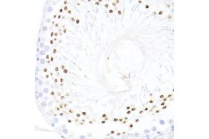 Immunohistochemistry of paraffin-embedded rat testis using DDX59 antibody (ABIN7266702) at dilution of 1:100 (40x lens). (DDX59 Antikörper  (AA 1-250))