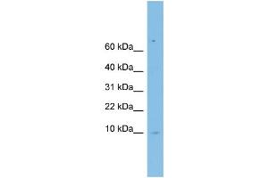 WB Suggested Anti-LSM6 Antibody Titration: 0. (LSM6 Antikörper  (Middle Region))