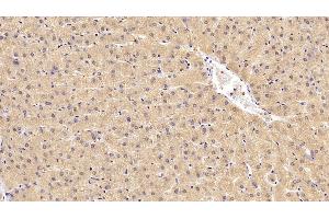 Detection of CEACAM1 in Human Liver Tissue using Monoclonal Antibody to Carcinoembryonic Antigen Related Cell Adhesion Molecule 1 (CEACAM1) (CEACAM1 Antikörper)