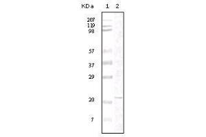 Western Blot showing FAK antibody used against truncated FAK recombinant protein. (FAK Antikörper)