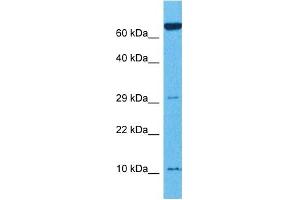 Host:  Rabbit  Target Name:  TNFRSF12A  Sample Tissue:  Mouse Thymus  Antibody Dilution:  1ug/ml (TNFRSF12A Antikörper  (N-Term))