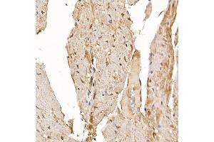 Immunohistochemistry (IHC) image for anti-Regulator of Calcineurin 1 (RCAN1) (AA 60-245) antibody (ABIN6146811)