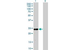 Western Blot analysis of MXI1 expression in transfected 293T cell line by MXI1 monoclonal antibody (M08), clone 1F3. (MXI1 Antikörper  (AA 73-182))