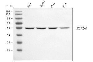 Western blot analysis of REXO4 using anti-REXO4 antibody (ABIN7599685).