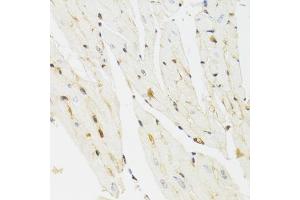 Immunohistochemistry of paraffin-embedded mouse heart using THAP1 antibody (ABIN5975558) at dilution of 1/100 (40x lens). (THAP1 Antikörper)