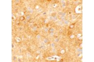 Immunohistochemical analysis of KCNK12 in mouse brain tissue with KCNK12 polyclonal antibody  at 5 ug/mL. (KCNK12 Antikörper  (C-Term))