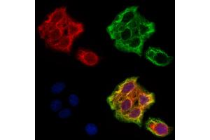 ABIN6265622 and ABIN6273178 staining Hela cells by IF/ICC. (TMSB4X Antikörper  (N-Term))