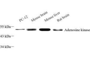 Western Blotting (WB) image for anti-Adenosine Kinase (ADK) antibody (ABIN7072953)
