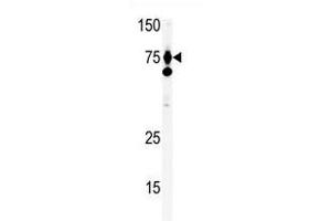 Image no. 1 for anti-Hepatocyte Growth Factor (Hepapoietin A, Scatter Factor) (HGF) (C-Term) antibody (ABIN357192)