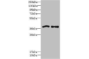 Western blot All lanes: FPR1 antibody at 6 μg/mL Lane 1: Colo320 whole cell lysate Lane 2: HT29 whole cell lysate Secondary Goat polyclonal to rabbit IgG at 1/10000 dilution Predicted band size: 39 kDa Observed band size: 39 kDa (FPR1 Antikörper  (AA 306-350))