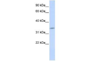 WB Suggested Anti-CDK5 Antibody Titration:  0. (CDK5 Antikörper  (N-Term))