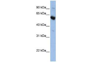 WB Suggested Anti-SLC45A3 Antibody Titration:  0. (SLC45A3 Antikörper  (Middle Region))