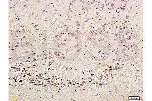 Formalin-fixed and paraffin embedded rat brain labeled with Rabbit Anti-CDK5 Polyclonal Antibody (ABIN670101) at 1:200 followed by conjugation to the secondary antibody and DAB staining.