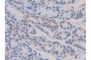 Immunohistochemistry (IHC) image for anti-Interleukin 11 Receptor, alpha (IL11RA) (AA 194-329) antibody (ABIN7438169)
