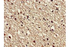 Immunohistochemistry (IHC) image for anti-Vacuolar Protein Sorting-Associated Protein 16 Homolog (VPS16) (AA 7-89) antibody (ABIN7175666)