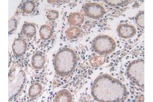 IHC-P analysis of Human Stomach Tissue, with DAB staining. (Utrophin Antikörper  (AA 1-252))