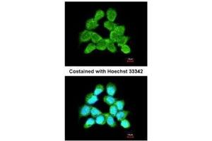ICC/IF Image Immunofluorescence analysis of methanol-fixed A431, using LARS2, antibody at 1:200 dilution. (LARS2 Antikörper)