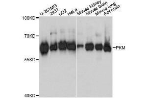 Western blot analysis of extracts of various cell lines, using PKM antibody. (PKM Antikörper  (AA 11-221))