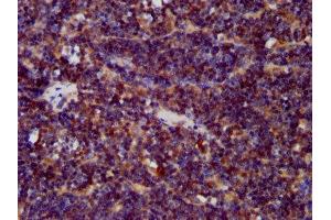 IHC image of ABIN7147311 diluted at 1:400 and staining in paraffin-embedded human lymph node tissue performed on a Leica BondTM system. (CDCA7L Antikörper  (AA 14-167))