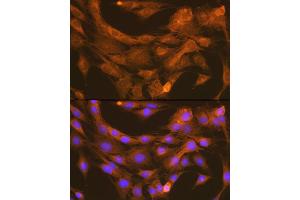 Immunofluorescence analysis of C6 cells using PDI Rabbit mAb (ABIN7269615) at dilution of 1:100 (40x lens).