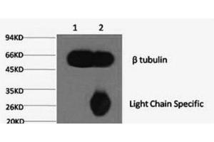 1) Input: Mouse brain tissue, 2) IP product: IP at dilution of 1: 200 (TUBB Antikörper)