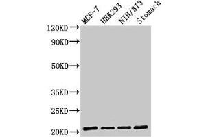 Western Blot Positive WB detected in: MCF-7 whole cell lysate, HEK293 whole cell lysate, NIH/3T3 whole cell lysate, Rat stomach tissue All lanes: CD3G antibody at 2 μg/mL Secondary Goat polyclonal to rabbit IgG at 1/50000 dilution Predicted band size: 21 kDa Observed band size: 21 kDa (CD3G Antikörper  (AA 138-182))