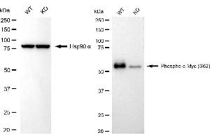 Western blotting analysis using phospho-c-Myc (S62) antibody (ABIN7799503). (Rekombinanter c-MYC Antikörper  (pSer62))
