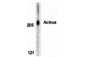 Western Blotting (WB) image for anti-Apoptotic Chromatin Condensation Inducer 1 (ACIN1) (C-Term) antibody (ABIN1030217)