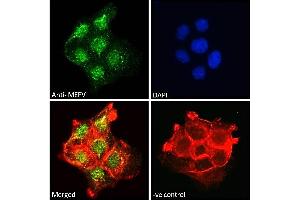 ABIN185451 Immunofluorescence analysis of paraformaldehyde fixed A431 cells, permeabilized with 0. (MEFV Antikörper  (Internal Region))