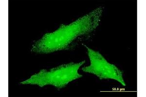 Immunofluorescence of monoclonal antibody to ODC1 on HeLa cell. (ODC1 Antikörper  (AA 1-461))