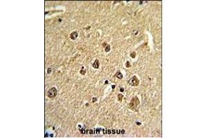 Formalin-fixed and paraffin-embedded human brain tissue reacted with PID/MTA2 Antibody (C-term), which was peroxidase-conjugated to the secondary antibody, followed by DAB staining.