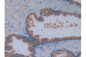 IHC-P analysis of Human Prostate Gland Tissue, with DAB staining. (MAG Antikörper  (AA 133-237))