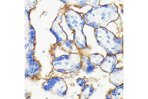 Immunohistochemistry of paraffin-embedded human placenta using [KO Validated] PD-L1/CD274 Rabbit mAb (ABIN7266178) at dilution of 1:100 (40x lens).