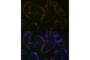 Immunofluorescence analysis of human placenta cells using CYP26 Rabbit mAb (ABIN7266654) at dilution of 1:100 (40x lens). (CYP26A1 Antikörper)
